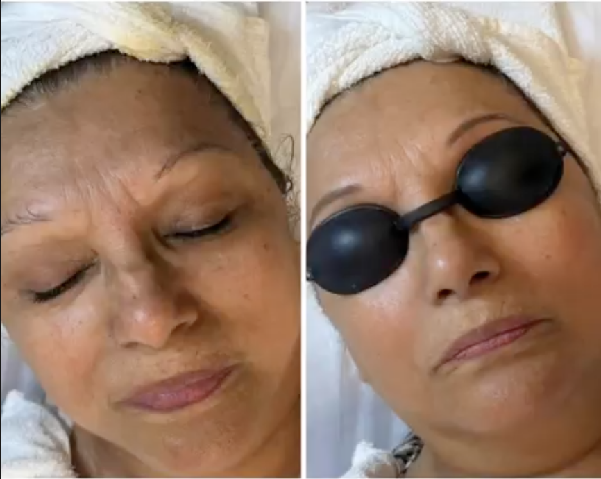 LED Light Therapy at Élévatione Med Spa